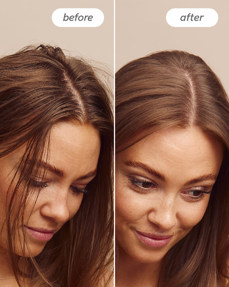 Scalp Delight™ Detox Conditioner - Image 9